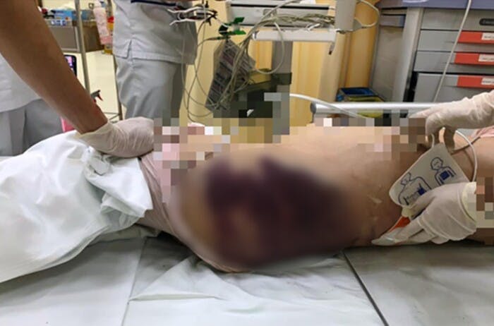 clinic operating theatre hospital person human arm